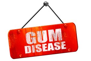 gum disease sign
