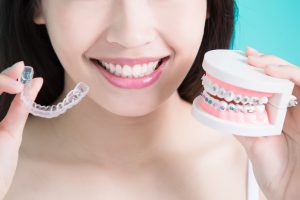 Woman holding braces or clear trays